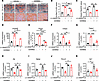 PPARγ inhibition partially inhibits ANGPTL8 expression and rescues the phen