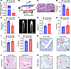 Administration of Angptl8-ASO partially rescues the phenotype of aging mice