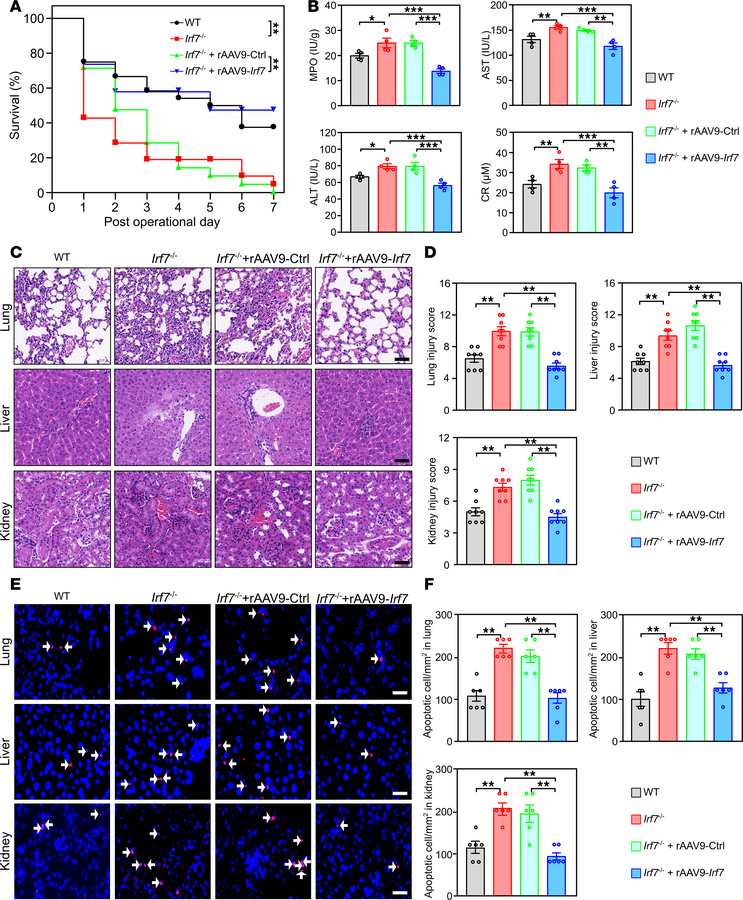 IRF7 is required for defense against polymicrobial sepsis.
(A) Effect of...