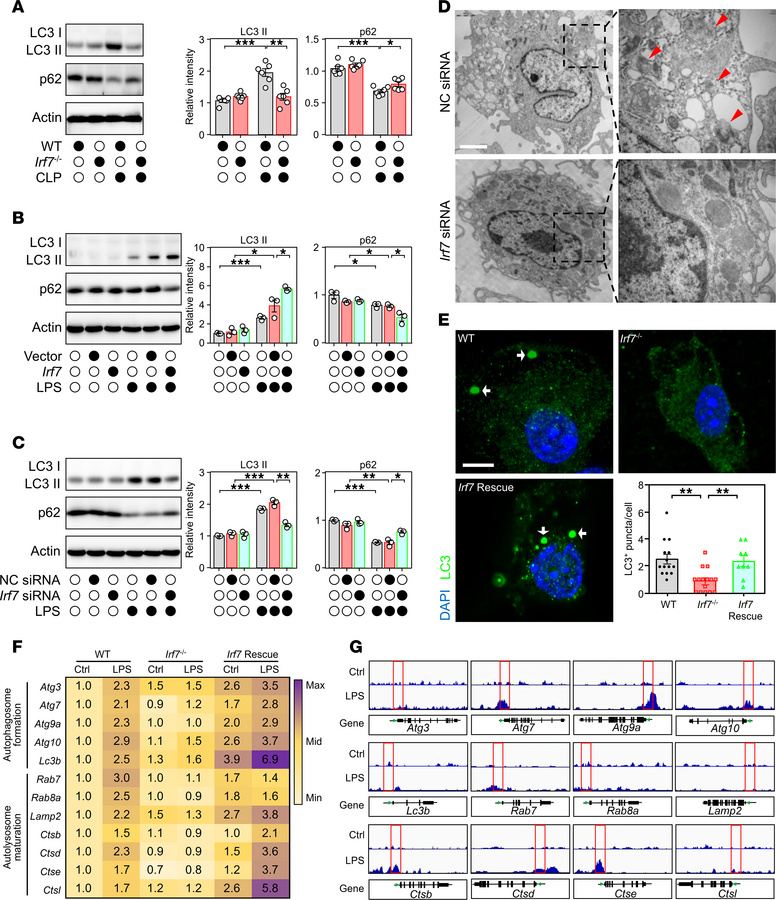 IRF7 promotes the autophagic response of macrophages during sepsis.
(A) ...