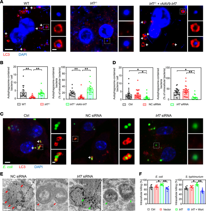 IRF7 triggers macrophages to kill bacteria via autophagy.
(A and B) Anal...