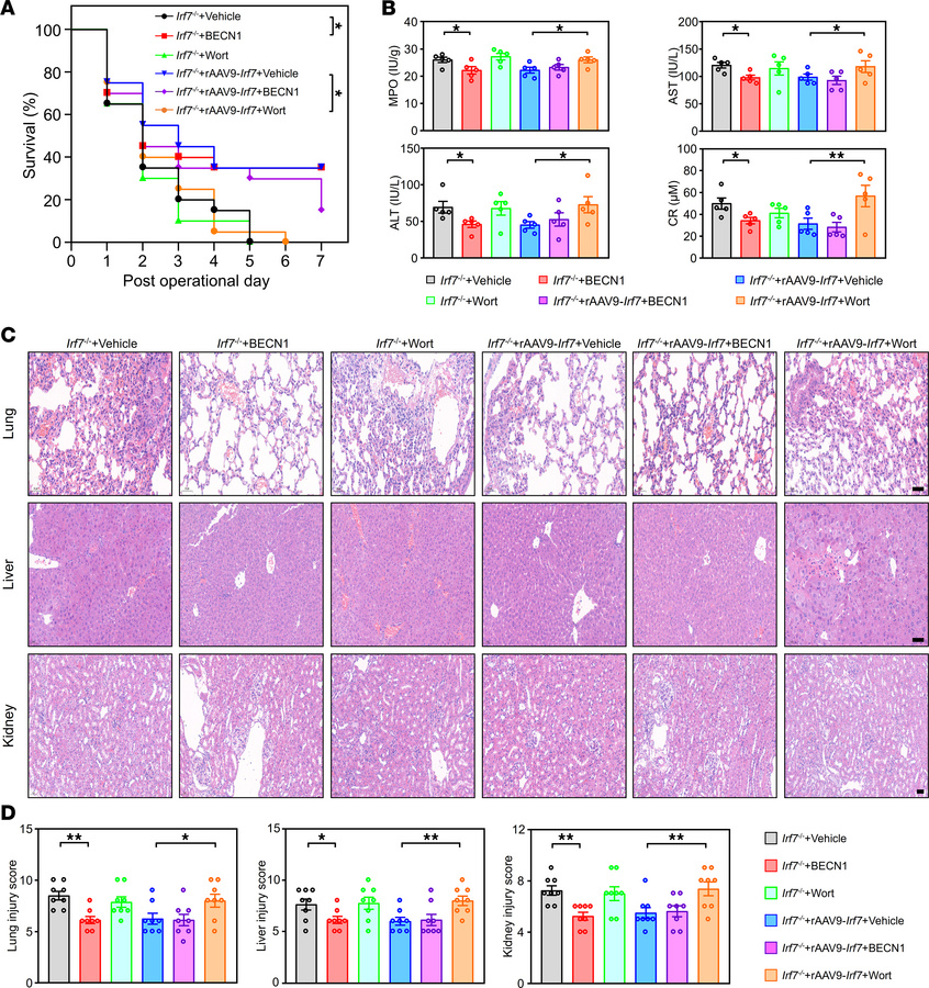 IRF7 defends against polymicrobial sepsis via autophagy.
(A) Survival ra...