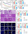 IRF7 is required for defense against polymicrobial sepsis.