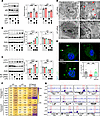 IRF7 promotes the autophagic response of macrophages during sepsis.