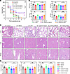 IRF7 defends against polymicrobial sepsis via autophagy.
