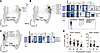 RV-related signatures map to T cell differentiation pathways in the lower a