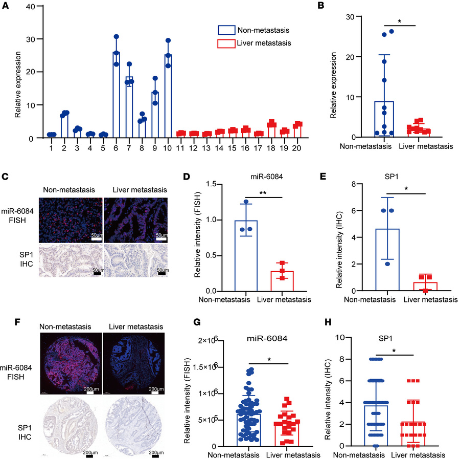 MiR-6084 is correlated with liver metastasis of patients with CRC.
(A) L...