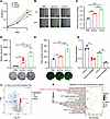 The impact of PBS, N-EVs, and H-EVs on the proliferation, migration, and tu