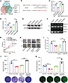 MiR-6084 inhibits angiogenesis by directly targeting ANGPTL4.
