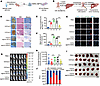 CRC-derived H-EVs promote angiogenesis and liver metastasis through EV miR-