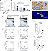 Loss of CD73 associates with recurrence and nuclear β-catenin in exon 3 CTN