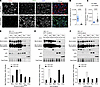 CD73 sequesters exon 3 mutant β-catenin to the cell membrane.