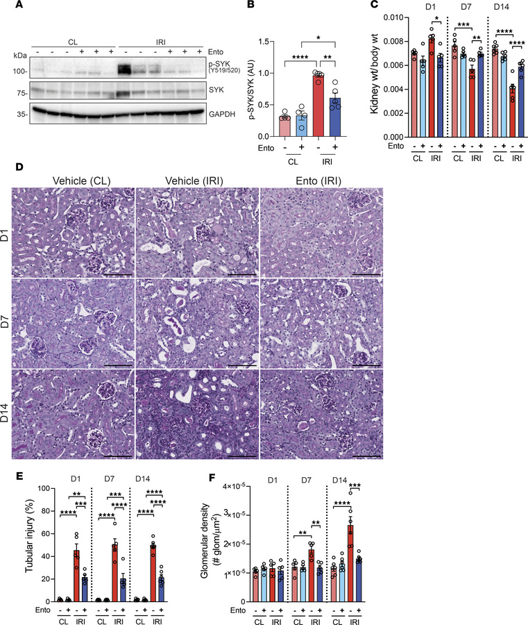 Entospletinib prevents IRI-induced AKI-to-CKD transition.
Kidney patholo...