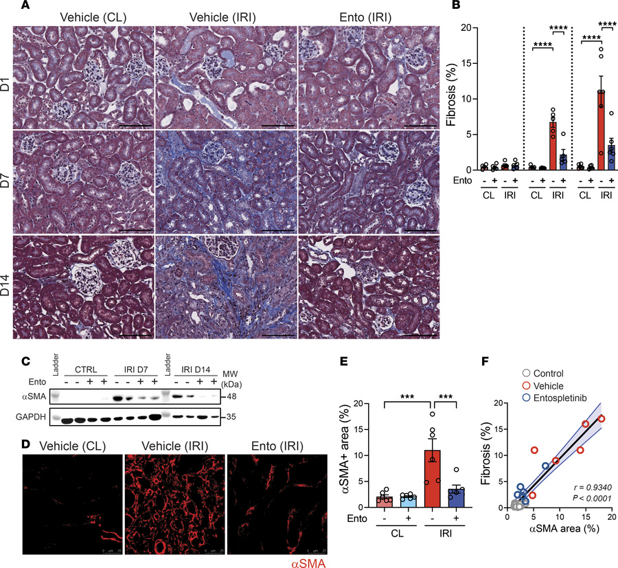Entospletinib reduces fibrosis during AKI-to-CKD transition.
(A) Represe...