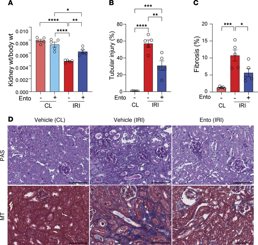 Entospletinib prevents AKI-to-CKD transition after established injury.
K...