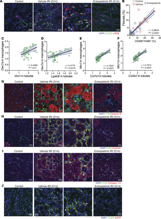 Macrophage interactions in the kidney during AKI-to-CKD transition.
(A) ...