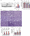 Entospletinib prevents IRI-induced AKI-to-CKD transition.