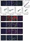 Macrophage interactions in the kidney during AKI-to-CKD transition.