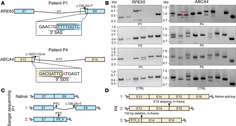 
RPE65 and ABCA4 transcript analysis in patient samples.
(A) Scheme high...