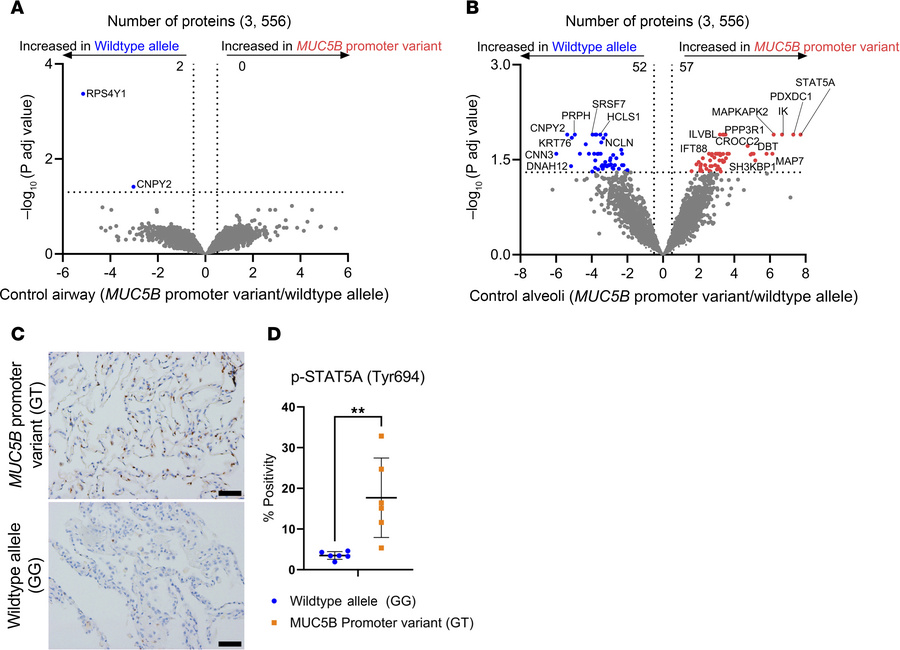 Impact of the MUC5B promoter variant on nonfibrotic control lung.
(A and...