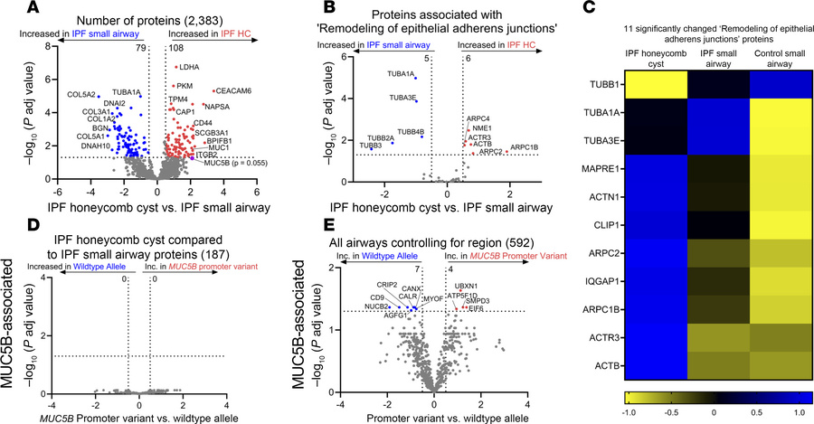 IPF honeycomb cysts are defined by remodeling of epithelial adherens jun...