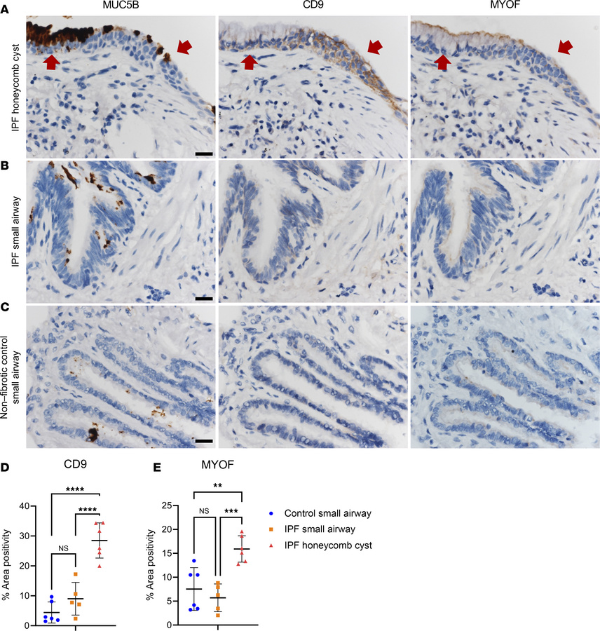 Airway expression of adhesion-associated proteins CD9 and myoferlin.
Rep...