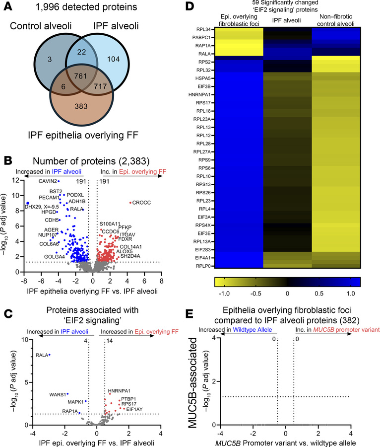 IPF epithelia overlying the fibroblastic foci (FF) are defined by cell s...