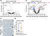 Impact of the MUC5B promoter variant on nonfibrotic control lung.
