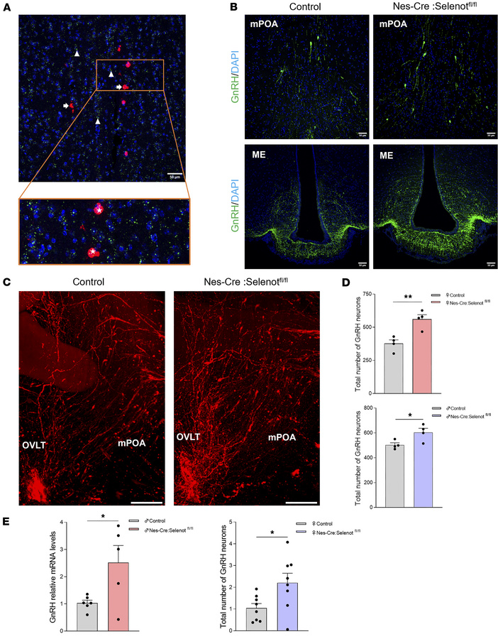 Distribution of GnRH neurons in the hypothalamus of Selenot–/– mice.
(A)...
