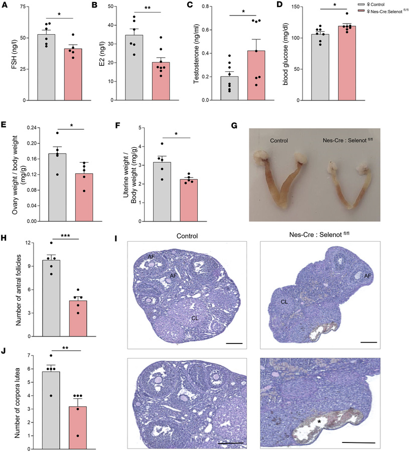 Hormone levels and ovarian morphology of brain SELENOT–deficient mice.
(...