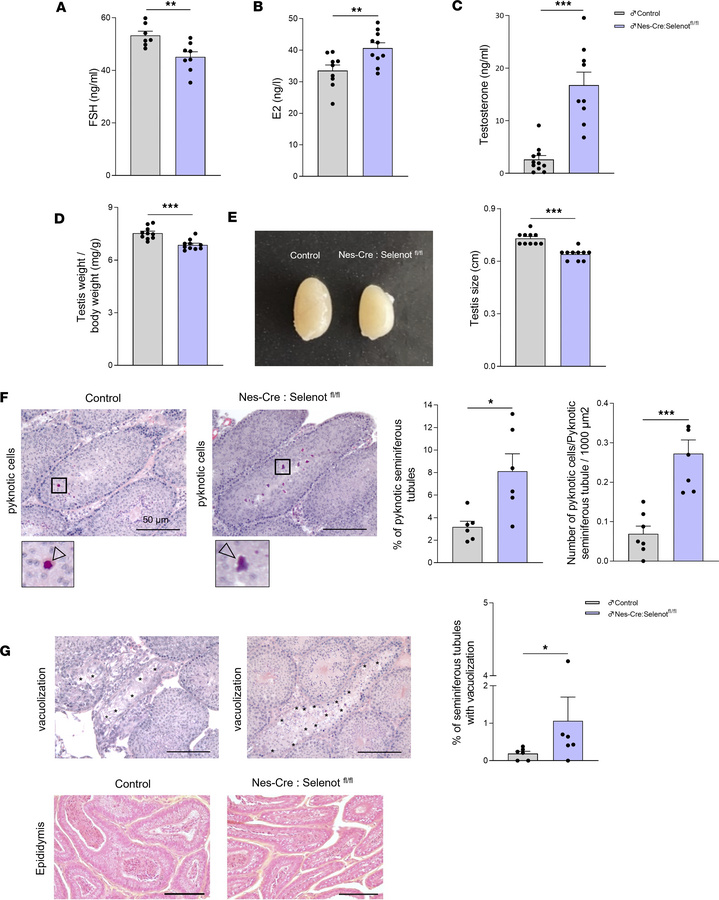 Hormone levels and testis morphology of brain SELENOT–deficient mice.
(A...