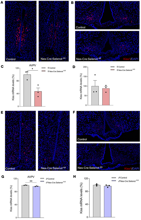 Analysis of the expression of kisspeptin mRNA by RNAScope in situ hybrid...