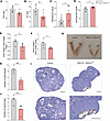 Hormone levels and ovarian morphology of brain SELENOT–deficient mice.