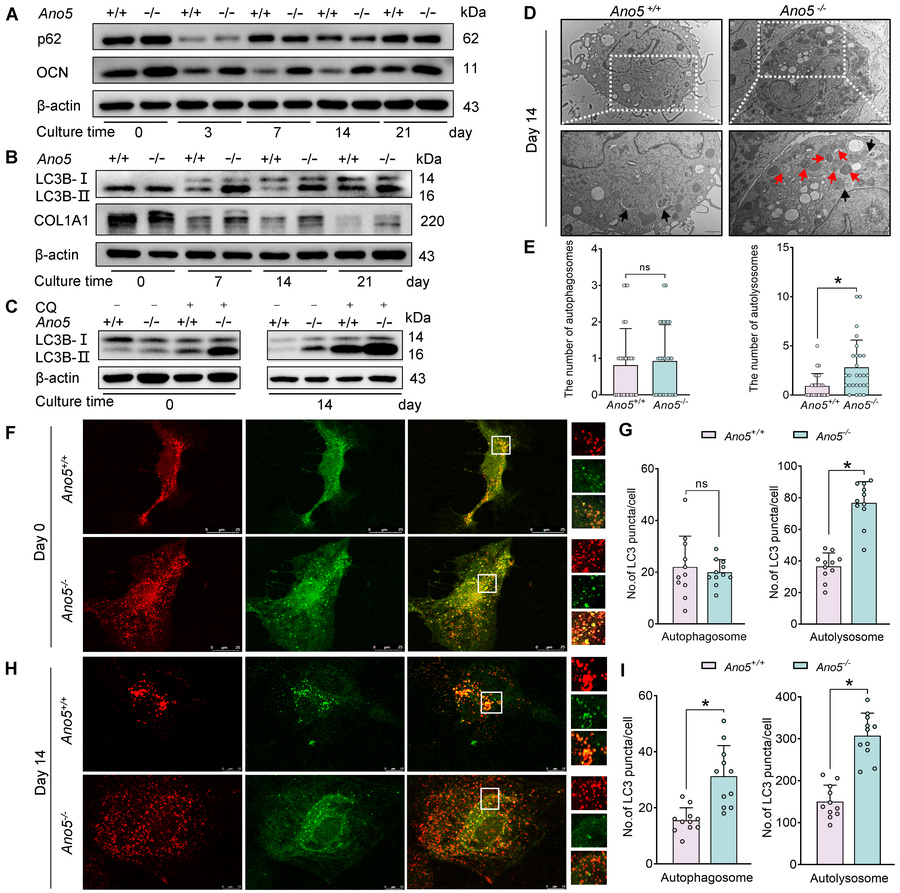 Autophagic flux is promoted by the absence of Ano5 in mCOBs.
(A and B) W...