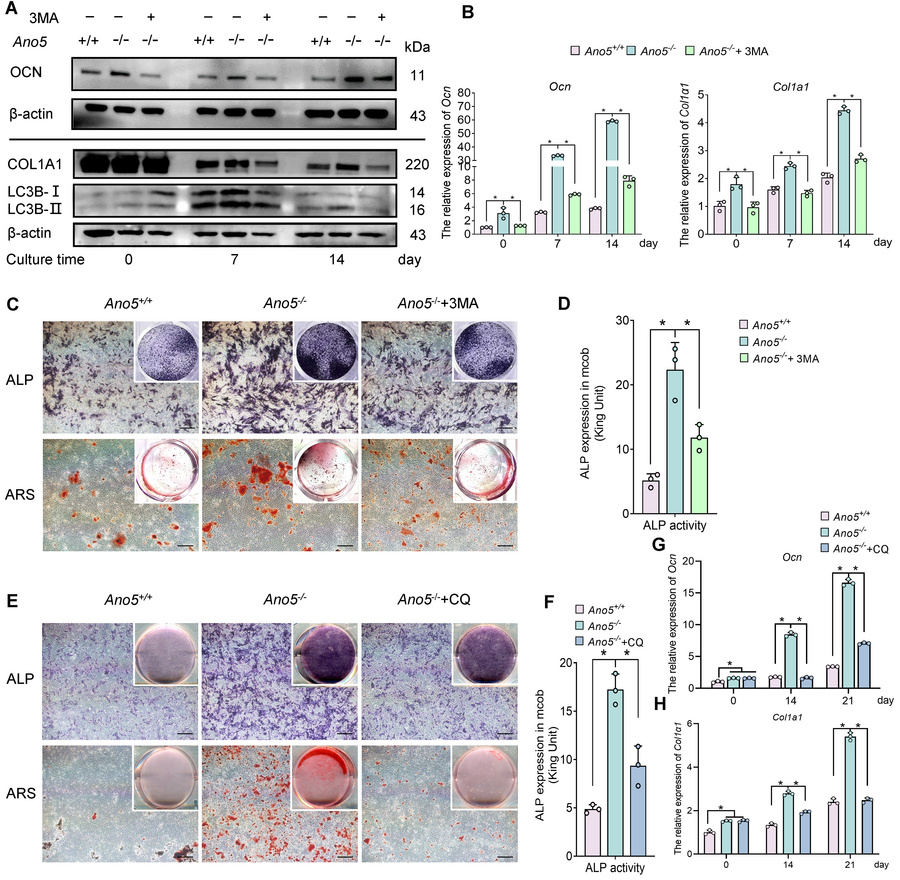 Inhibition of autophagy mitigates the aberrant osteogenic capacity in An...