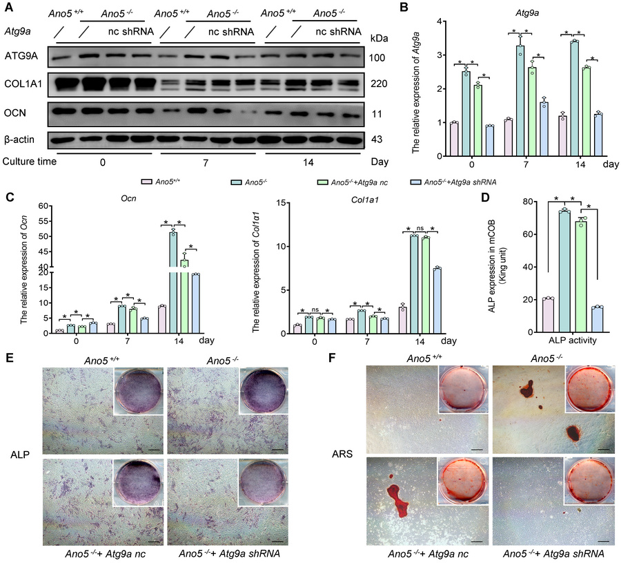 ATG9A is involved in autophagy-mediated osteogenesis regulation in Ano5–...