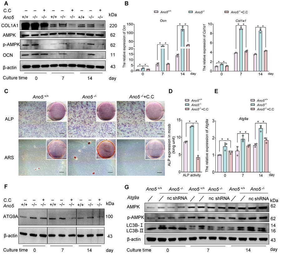 AMPK is involved in autophagy regulation in Ano5–/– mCOBs.
(A) Schematic...