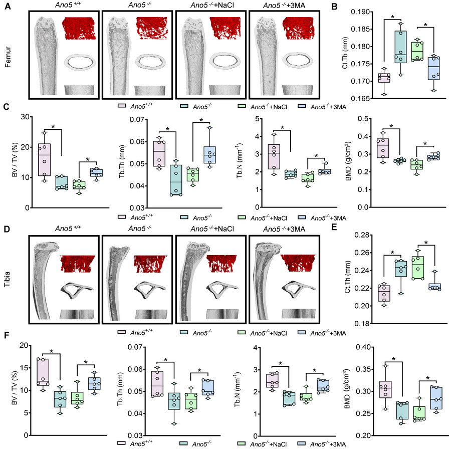 In vivo administration of 3-MA alleviated the abnormal phenotype in Ano5...