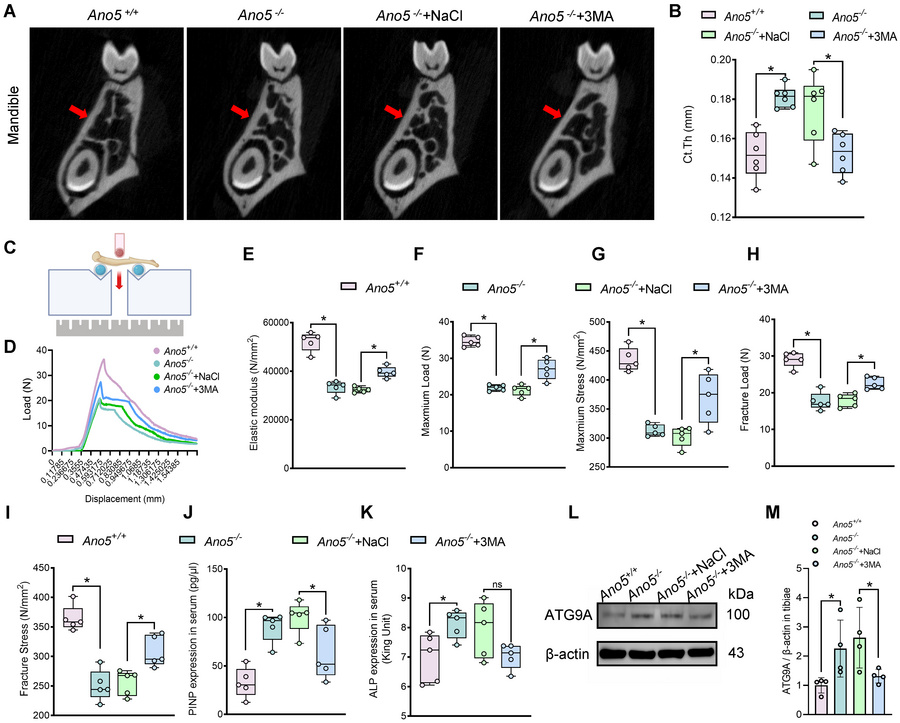 In vivo administration of 3-MA alleviated the abnormal phenotype in Ano5...