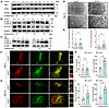 Autophagic flux is promoted by the absence of Ano5 in mCOBs.