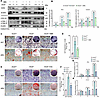 Inhibition of autophagy mitigates the aberrant osteogenic capacity in Ano5–