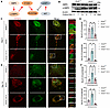AMPK regulates osteogenic function and is positioned upstream of ATG9A.