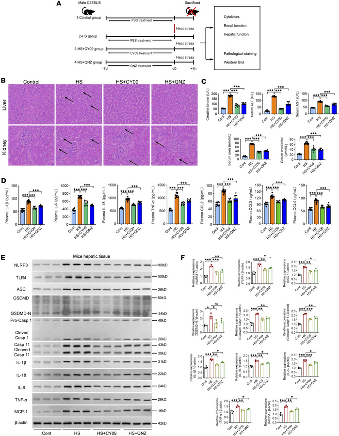The effect of pretreatment with NLRP3 inflammasome or TNF-α blockade on ...
