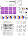 The effect of pretreatment with NLRP3 inflammasome or TNF-α blockade on the