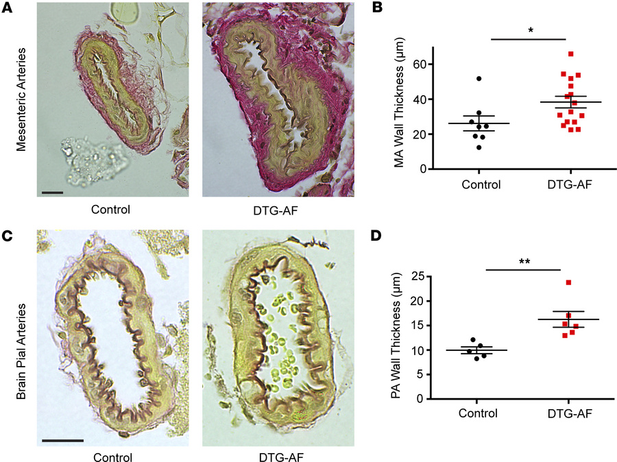 Vascular remodeling in DTG-AF brain and pial arteries.
(A and B) Elastin...