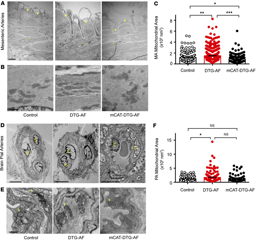 Vascular ultrastructural alterations in DTG-AF vessels.
(A) Transmission...