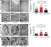 Vascular ultrastructural alterations in DTG-AF vessels.