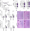 Loss of the BA transporters Slco1a and Slco1b reduces T cell–mediated liver