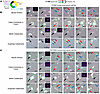 Fates of lung cancer cells after CDK2 antagonism with CYC065 treatment.