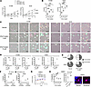 The effects of the CDK2 specific inhibitor PF07104091 on cancer cell prolif